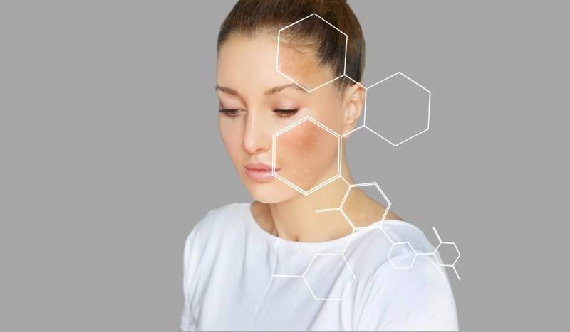 nguyên nhân da bị sạm đen