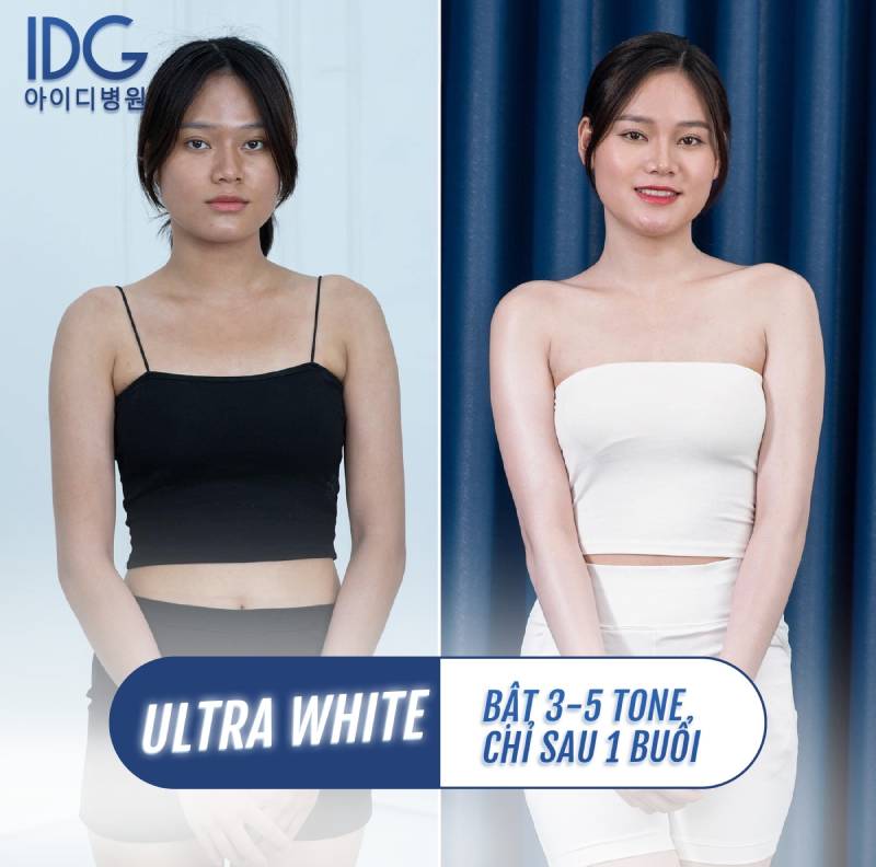 công nghệ phun trắng ultra white